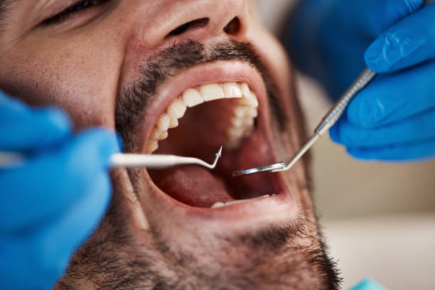 Best Emergency Denture Repair in Burns, TN