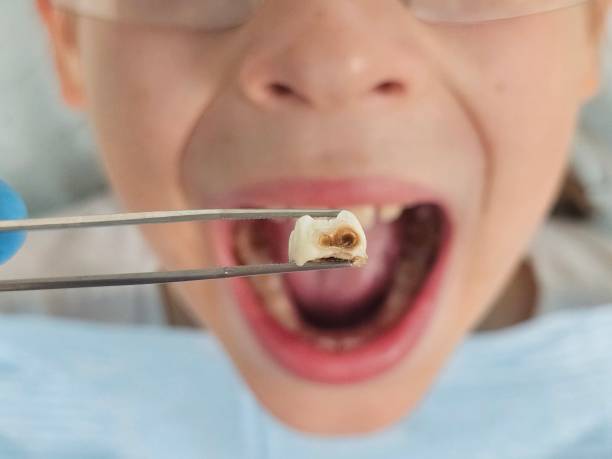 Best Emergency Pediatric Dental Care in Burns, TN